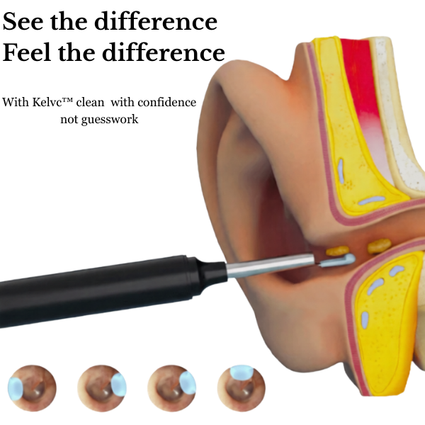 Kelvc™ Pro Ear Cleaner